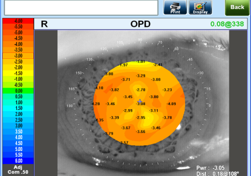 OPD_Scan_III_Foto3